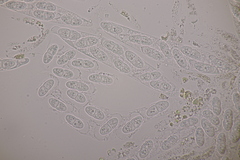 Melanconis stilbostoma