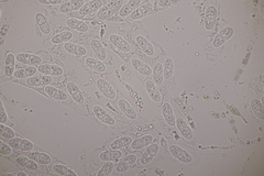 Melanconis stilbostoma