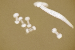 Melanconis stilbostoma