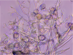 Peronospora alsinearum