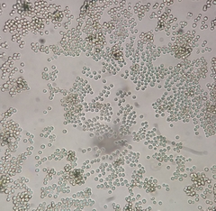 Aspergillus