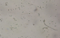 Aspergillus