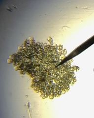 Dolichospermum lemmermannii