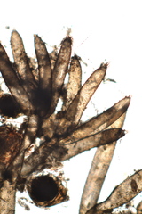 Nitella hyalina