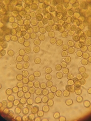 Perichaena corticalis