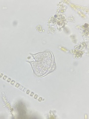 Protoperidinium
