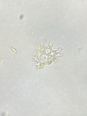 Pediastrum duplex
