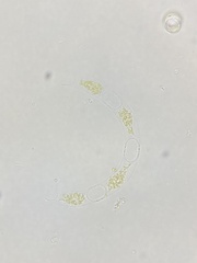 Eucampia