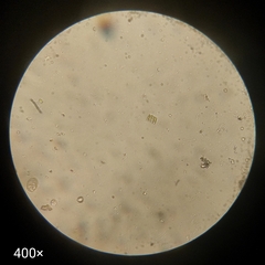 Scenedesmaceae