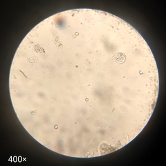 Aspidisca