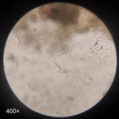 Bacteria