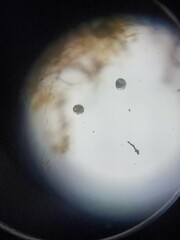 Vorticella campanula