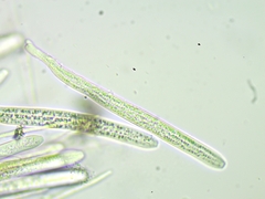 Lachnellula pseudofarinacea