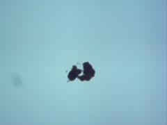 Dolichospermum lemmermannii