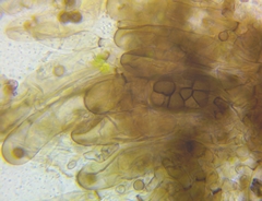 Berkleasmium concinnum