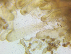 Berkleasmium concinnum