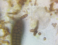 Berkleasmium concinnum