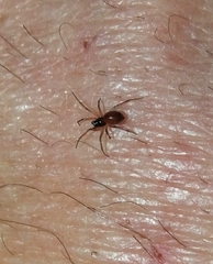 Ostearius melanopygius