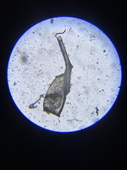 Pediculus humanus capitis