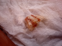 Gastropoda