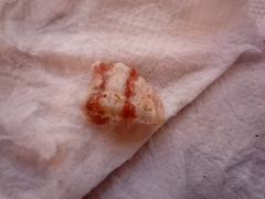 Gastropoda