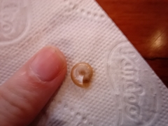 Gastropoda