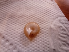 Gastropoda