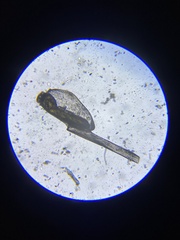 Pediculus humanus capitis