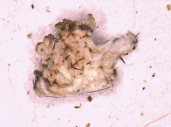 Imshaugia placorodia