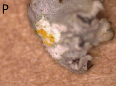 Imshaugia placorodia