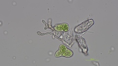 Pseudoidium hardenbergiae