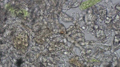 Pseudoidium hardenbergiae