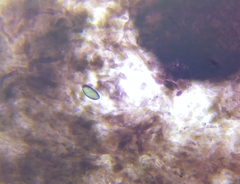 Hypomontagnella submonticulosa