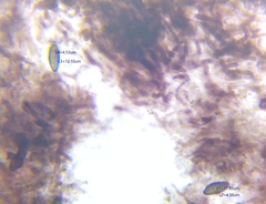 Hypomontagnella submonticulosa