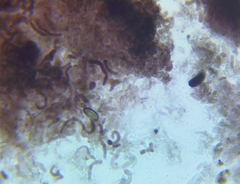 Hypomontagnella submonticulosa