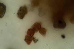 Lophoziopsis excisa