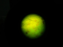 Puccinia carthami