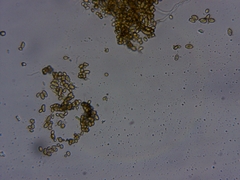 Chaenotheca laevigata