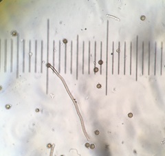 Disciseda subterranea