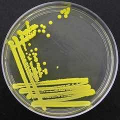 Micrococcus luteus