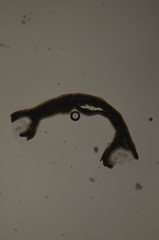 Platismatia stenophylla