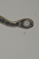 Platismatia stenophylla