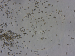 Chaenotheca laevigata