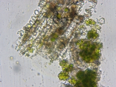 Chaenotheca laevigata