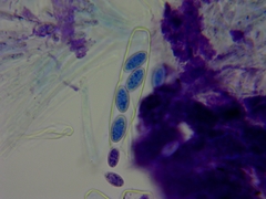 Peziza griseorosea