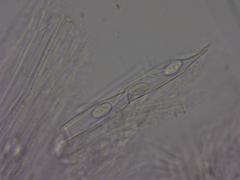 Peziza griseorosea