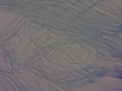 Peziza griseorosea