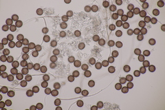 Didymium squamulosum