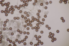 Didymium squamulosum