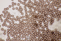 Didymium squamulosum